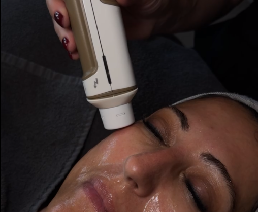 Hautbehandlung mit FLOW TIP® im studio of senses