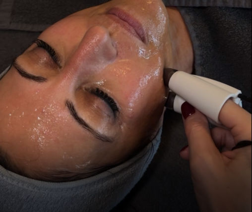 Hautbehandlung mit FUTURACONTOUR® im studio of senses